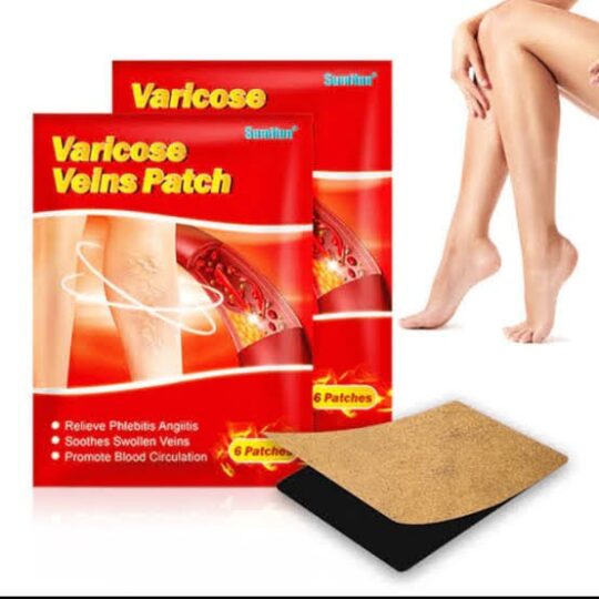 PARCHE DE VARICES